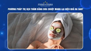 trị sẹo thâm bằng dưa chuột