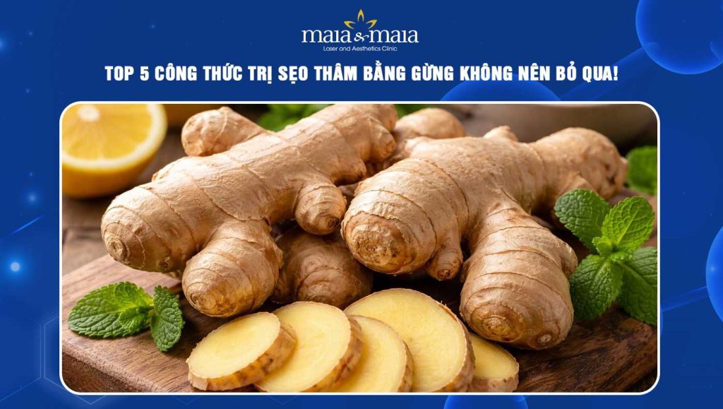 trị sẹo thâm bằng gừng