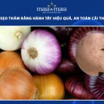 trị sẹo thâm bằng hành tây