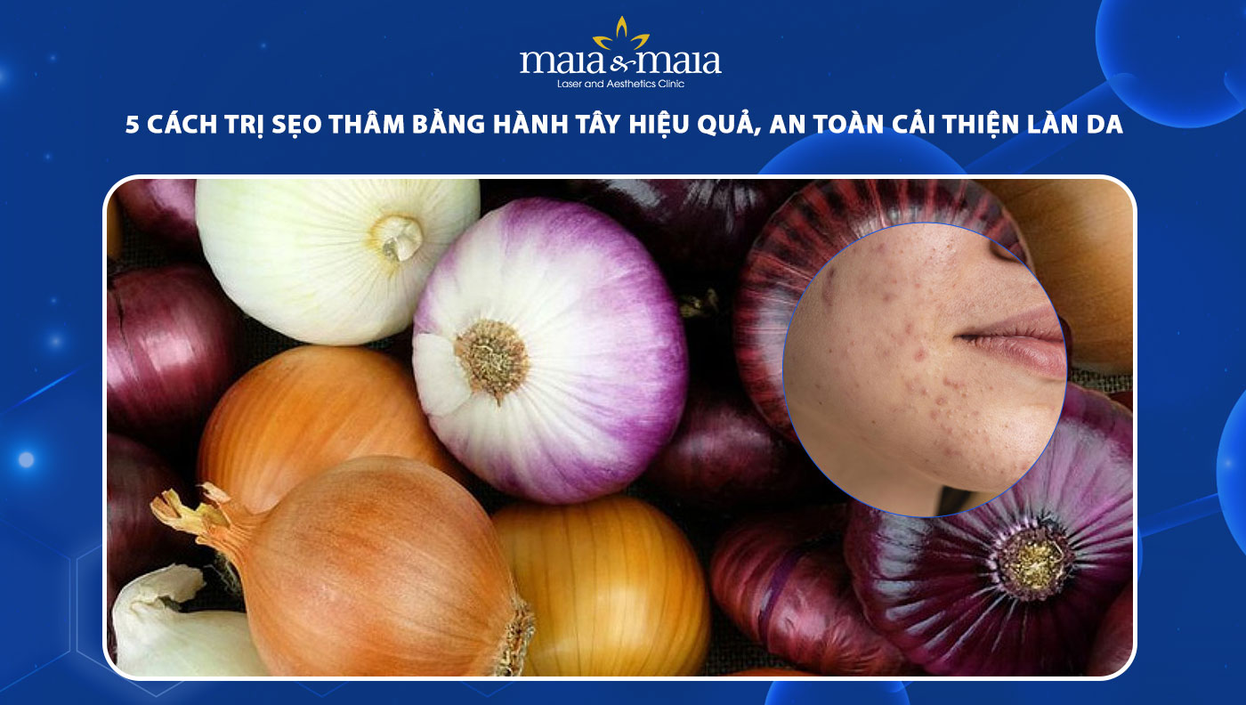 trị sẹo thâm bằng hành tây