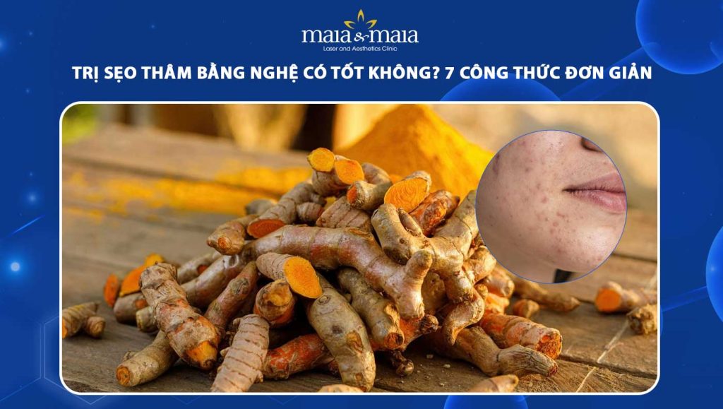 trị sẹo thâm bằng nghệ