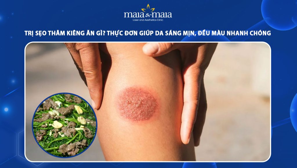 trị sẹo thâm kiêng ăn gì