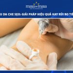 xăm màu da che sẹo