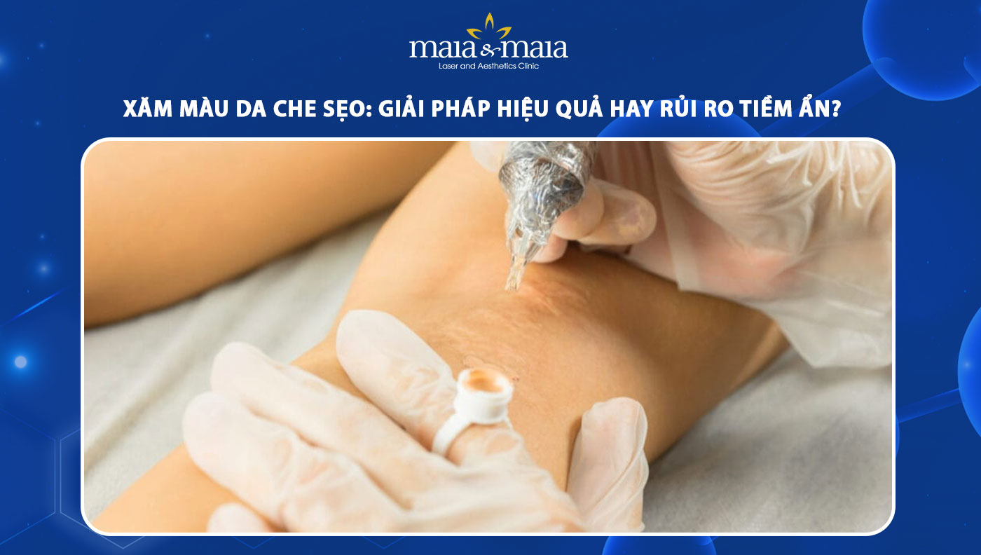 xăm màu da che sẹo