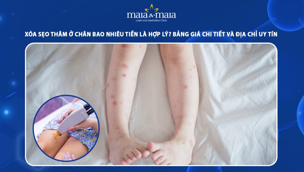 Xóa sẹo thâm ở chân bao nhiêu tiền là hợp lý? Bảng giá chi tiết và địa chỉ uy tín 1 xoá sẹo thâm ở chân bao nhiêu tiền