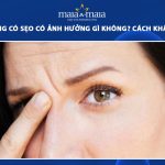 ấn đường có sẹo