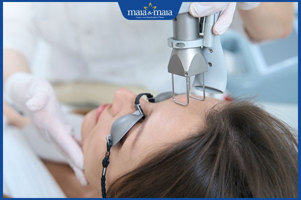 bắn laser co2 trị sẹo trắng