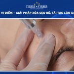 cấy da siêu vi điểm