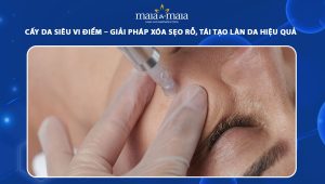 cấy da siêu vi điểm