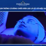 điều trị mụn trứng cá bằng chiếu đèn LED
