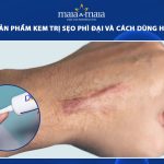 kem trị sẹo phì đại