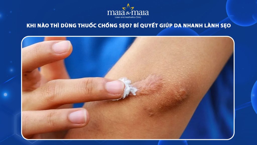 Khi nào thì dùng thuốc chống sẹo? Bí quyết giúp da nhanh lành sẹo 1 khi nào thì dùng thuốc chống sẹo