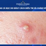 mụn trứng cá bọc