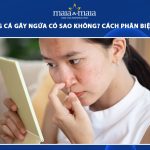 mụn trứng cá gây ngứa