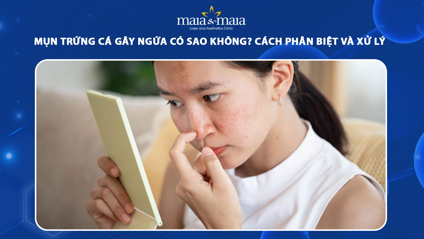 mụn trứng cá gây ngứa