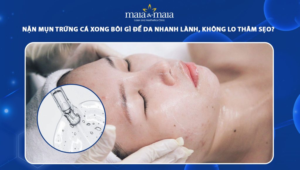 Nặn mụn trứng cá xong bôi gì để da nhanh lành, không thâm sẹo? 1 nặn mụn trứng cá xong bôi gì
