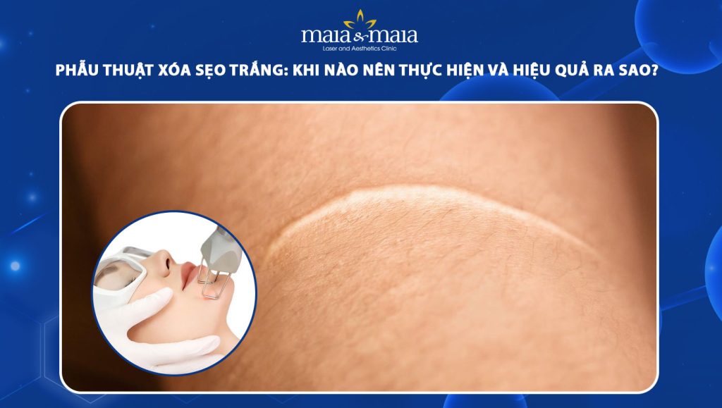 phẫu thuật xóa sẹo trắng