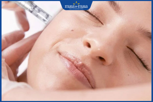 phương pháp cấy da siêu vi điểm