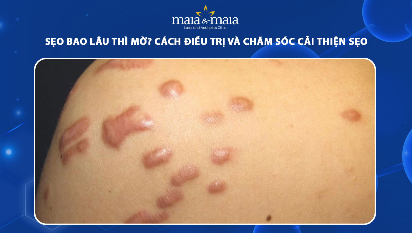 sẹo bao lâu thì mờ