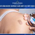 sẹo lồi có xăm được không