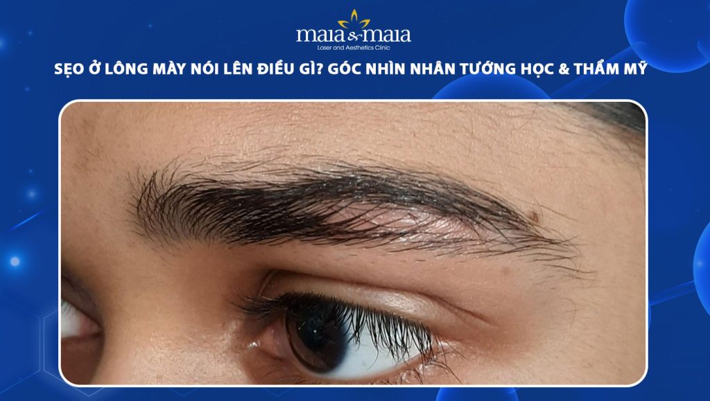 Sẹo ở lông mày nói lên điều gì? Góc nhìn nhân tướng học & thẩm mỹ 1 sẹo ở lông mày