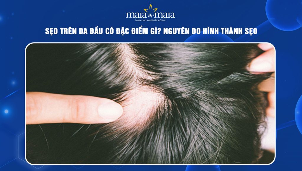 sẹo trên da đầu