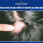 sẹo trên da đầu