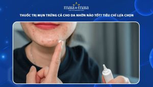 thuốc trị mụn trứng cá cho da nhờn