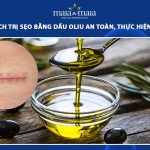 trị sẹo bằng dầu oliu