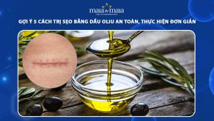 trị sẹo bằng dầu oliu