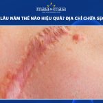 trị sẹo lâu năm