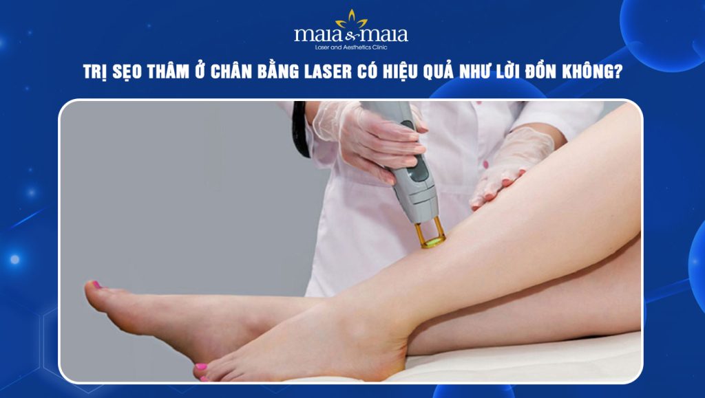 trị sẹo thâm ở chân bằng laser