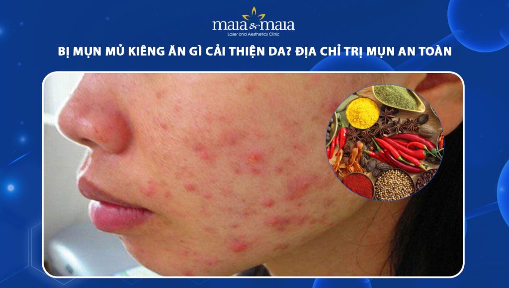 Bị mụn mủ kiêng ăn gì cải thiện da? Địa chỉ trị mụn an toàn 1 bị mụn mủ kiêng ăn gì