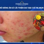 bị mụn mủ kiêng ăn gì