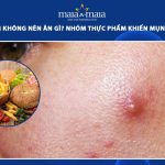bị mụn viêm không nên ăn gì