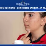 cách làm mụn bọc nhanh chín