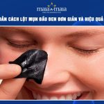 cách lột mụn đầu đen