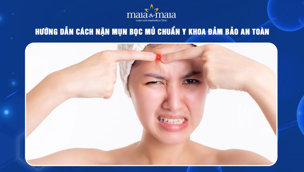cách nặn mụn bọc mủ