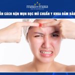 cách nặn mụn bọc mủ