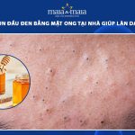 cách trị mụn đầu đen bằng mật ong