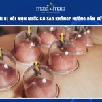 giác hơi bị nổi mụn nước