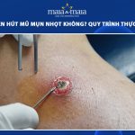 hút mủ mụn nhọt