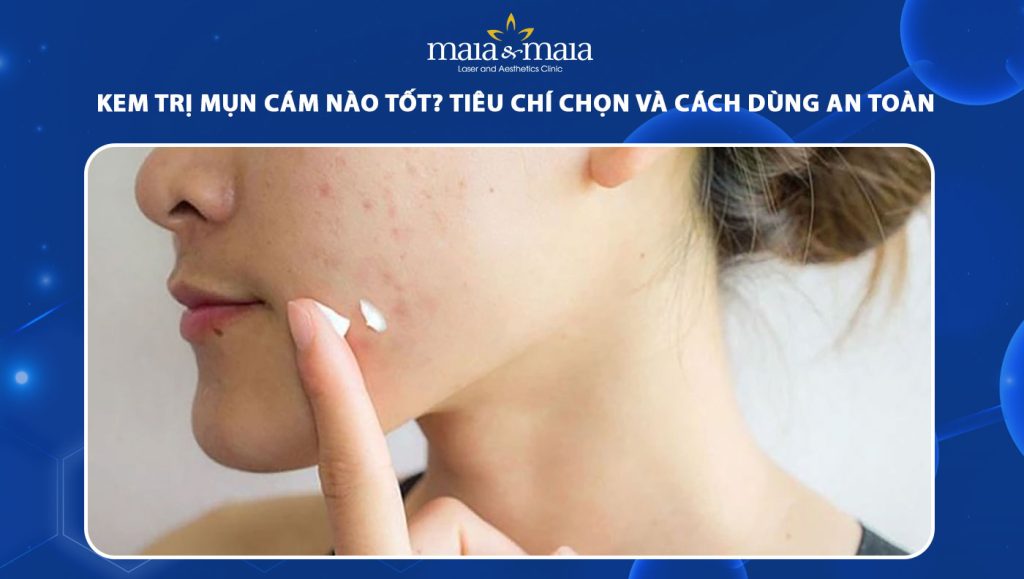kem trị mụn cám
