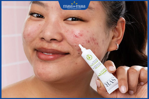 kem trị mụn svr