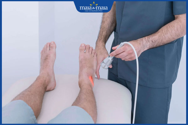 Mụn nước ở chân là bệnh gì? Cách xử lý an toàn và ngăn tái phát 4 laser trị mụn nước ở chân