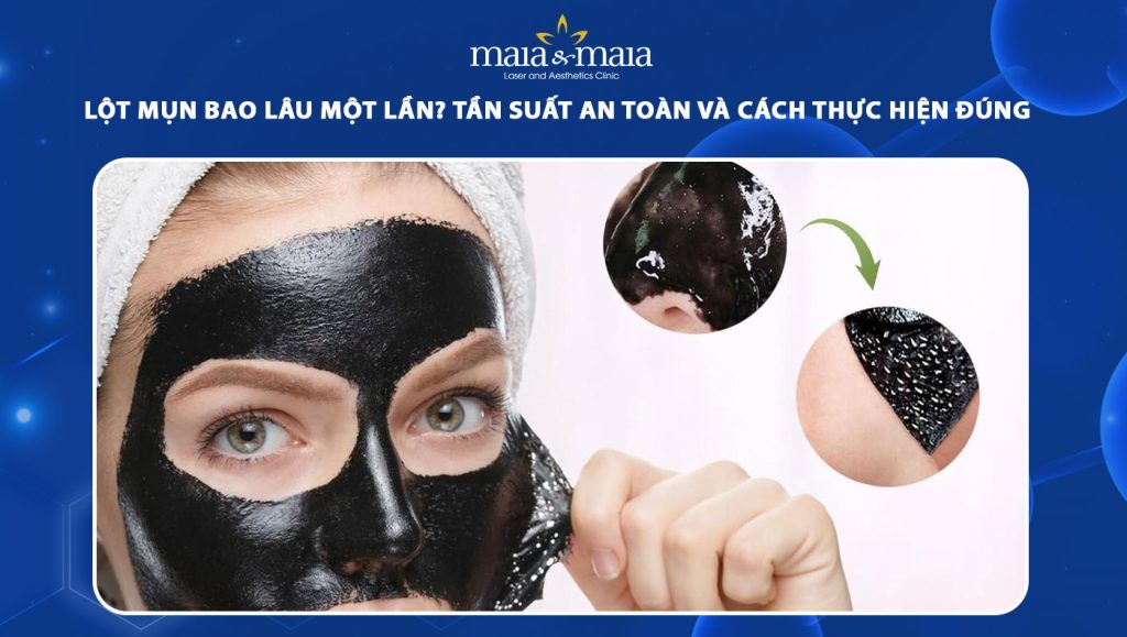 lột mụn bao lâu một lần