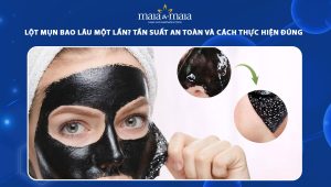 lột mụn bao lâu một lần