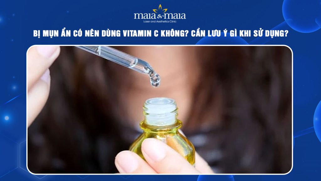 mụn ẩn có nên dùng vitamin c