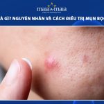 mụn bọc