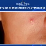 mụn bọc có tự xẹp không